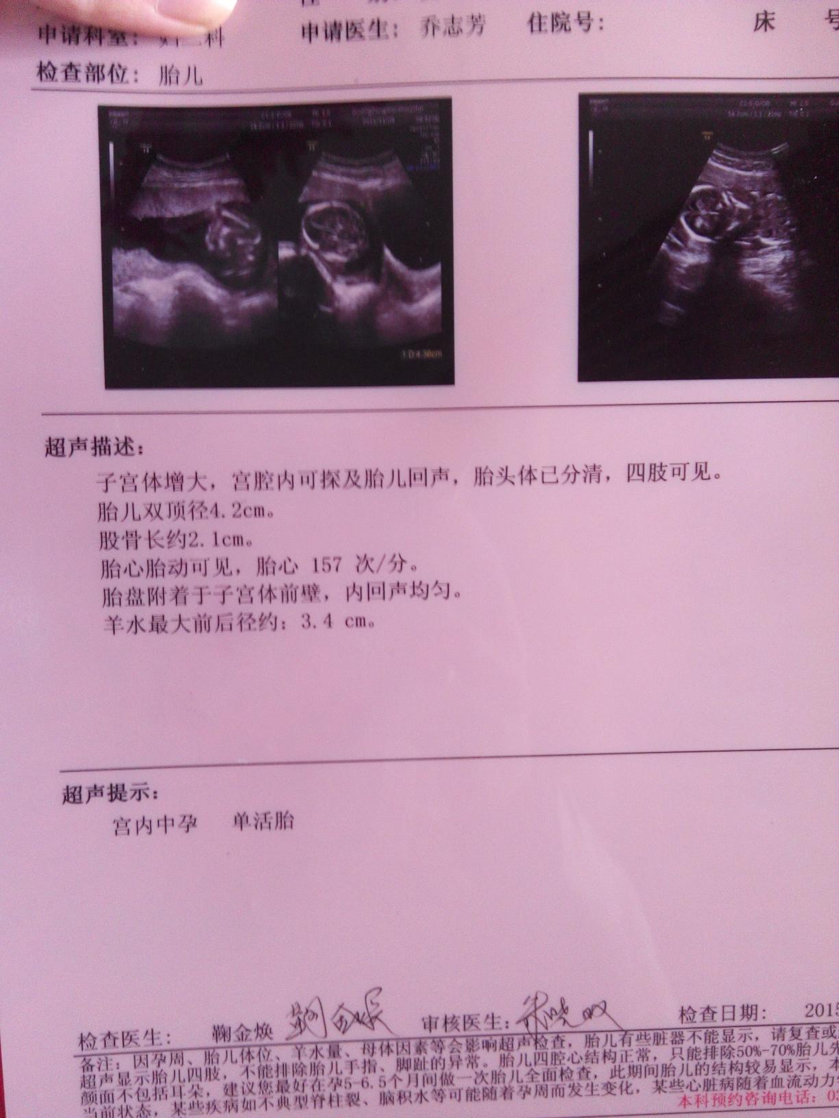 beat365亚洲体育官方网站_二连口岸木材积压依然严重(图1) beat·365